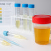 Creatininecorrectie in urinetests