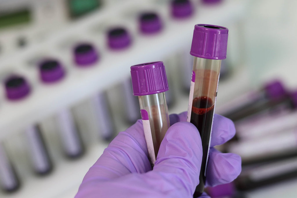 5 veelvoorkomende mythes over thuisdiagnostiek ontkracht – waarom Medivere?